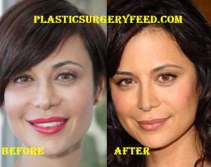 Catherine Bell Nose Job and Lips Surgery