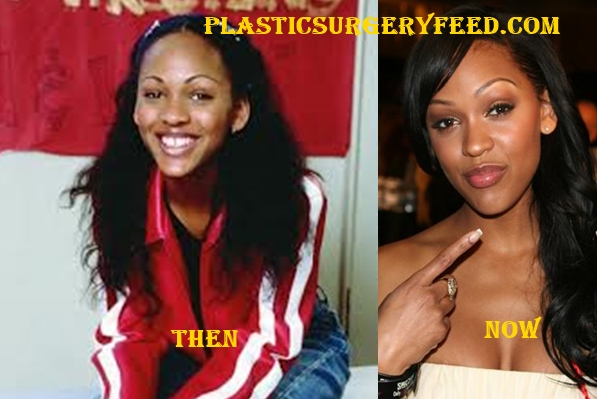 Meagan Good Botox