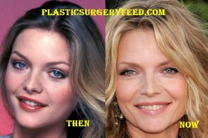 Michelle Pfeiffer Botox
