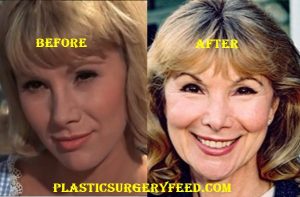 Susan Hampshire Before and After