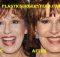 Joy Behar Botox and Facelift