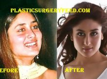 Kareena Kapoor Breast Implants