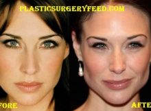 Claire Forlani Jaw Implant