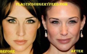 Claire Forlani Jaw Implant