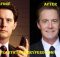 Kyle MacLachlan Botox and Facelift