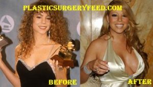 Mariah Carey Breast Implants Boobs Job