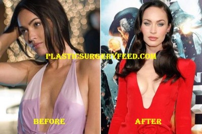 Megan Fox Breast Implants