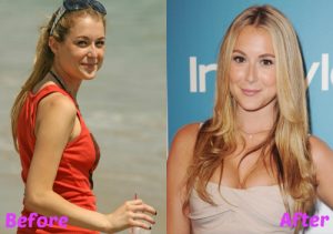 Alexa Vega Nose Job Rhinoplasty