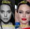 Angelina Jolie Botox