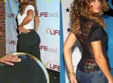 Beyonce Buttock Implant