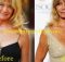 Goldie Hawn Breast Implant