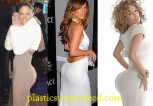 Jennifer Lopez Buttock Implants