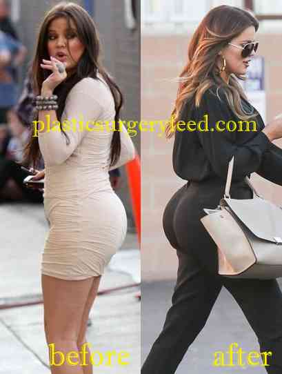Khloe Kardashian Buttock