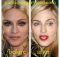 Madonna Lips Implant
