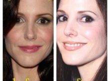 Mary Louise Parker Botox and Facelift
