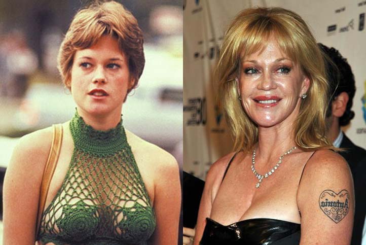 Melanie Griffith Breast Implant Plastic Surgery Feed