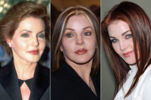 Priscilla Presley Plastic Surgery Before After