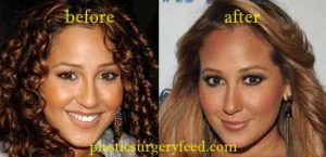 Adrienne Bailon Rhinoplasty Nose Job