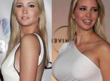 Ivanka Trump Breast Implant