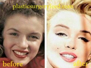 Marilyn Monroe Nose Surgery