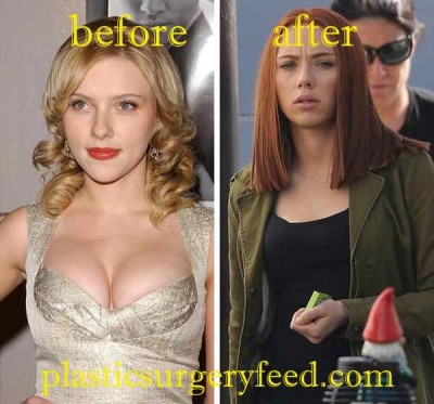 Scarlett Johansson Breast Reduction