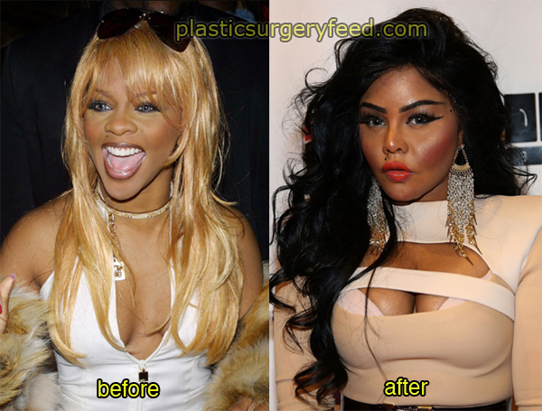 Lil Kim Before and After Breast Implants