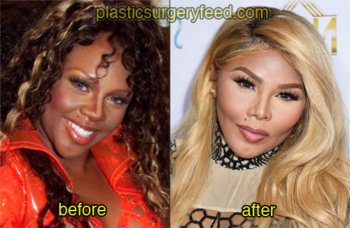 lil kim before and after plastic surgery 1