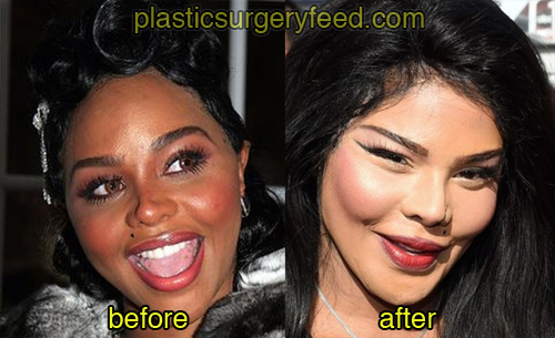 lil kim before and after plastic surgery 2