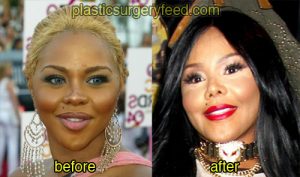 lil kim before and after plastic surgery 3