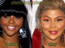 lil kim before and after plastic surgery 4