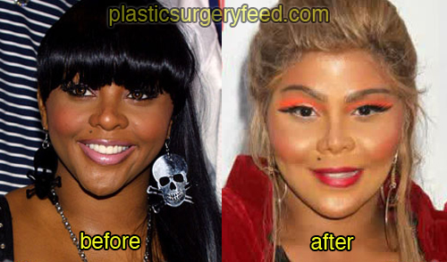 lil kim before and after plastic surgery 4