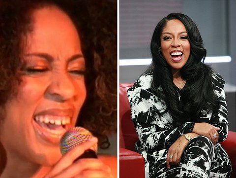 K Michelle teeth before and after