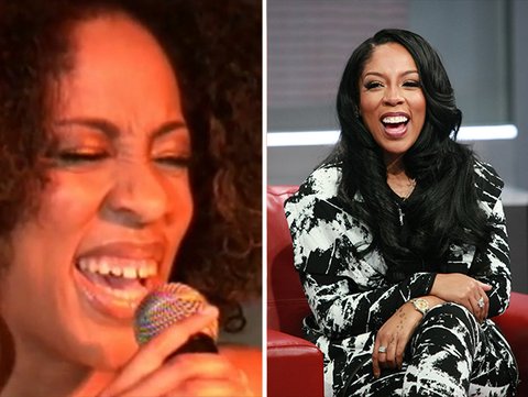 K Michelle teeth before and after