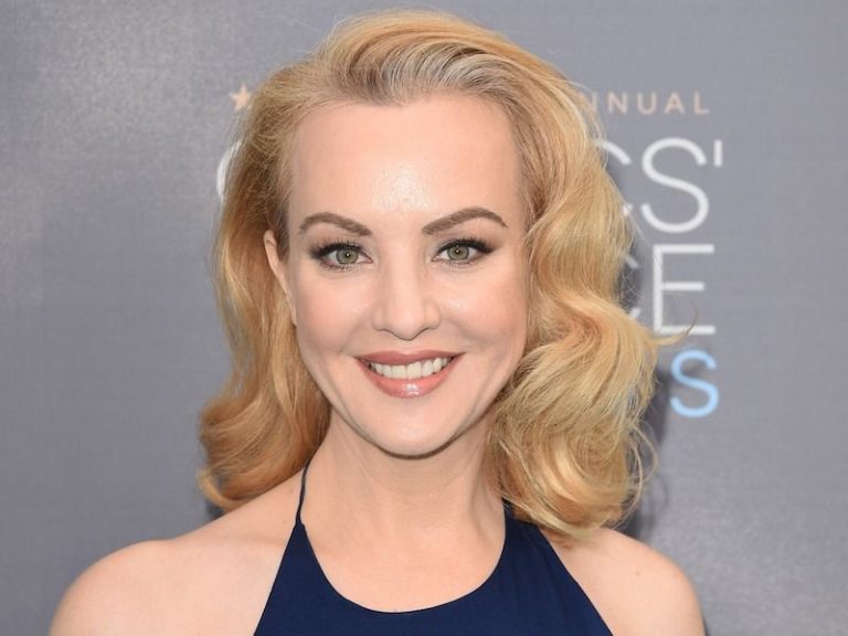 Wendi McLendon-Covey Plastic Surgery