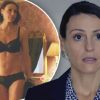 Suranne Jones Plastic Surgery