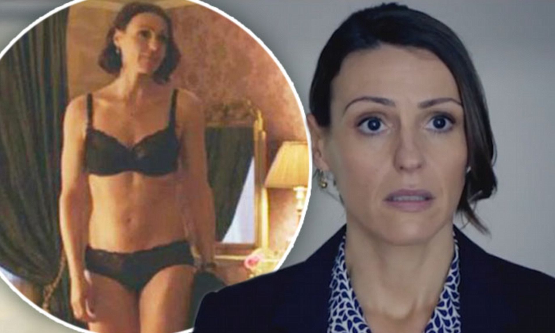Suranne Jones' Boob Job - Before and After Images - Plastic Surger...