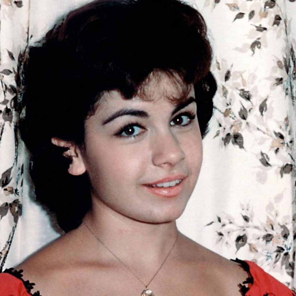Annette Funicello Cosmetic Surgery Face