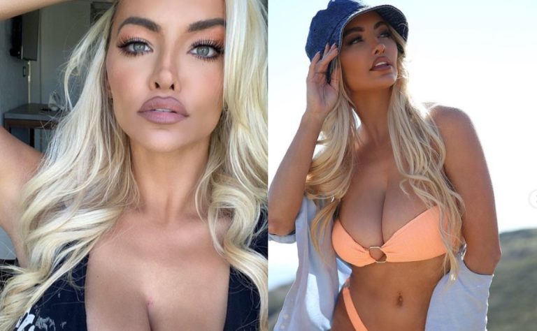 Lindsey Pelas Plastic Surgery