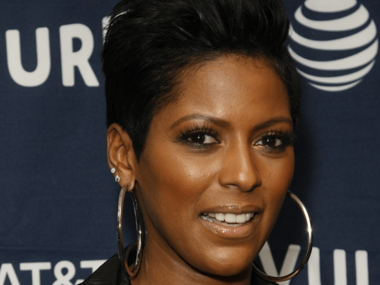 Tamron Hall Plastic Surgery