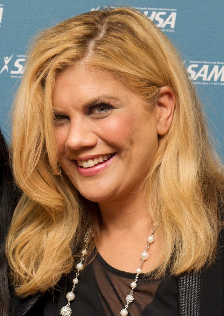 Kristen Johnston Plastic Surgery Face