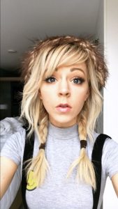 Lindsey Stirling Plastic Surgery Face