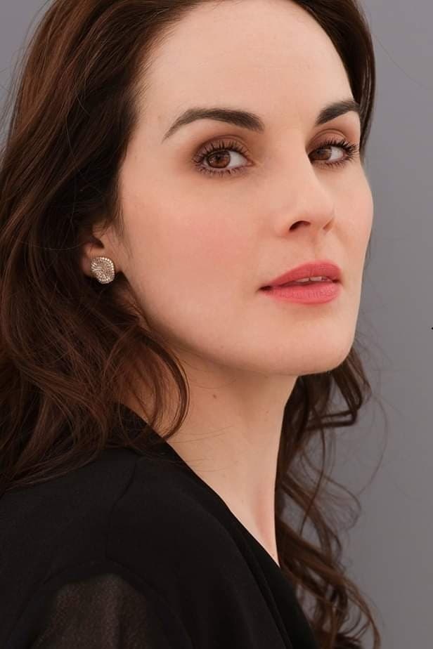 Michelle Dockery Cosmetic Surgery Face