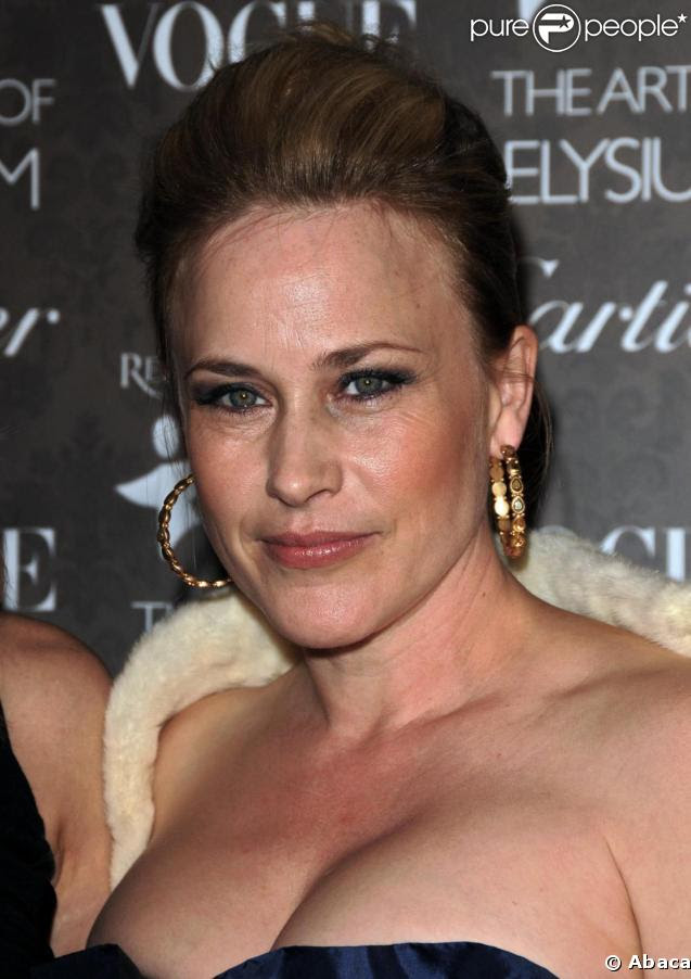 Patricia Arquette Plastic Surgery Face