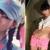 Bai Ling Plastic Surgery