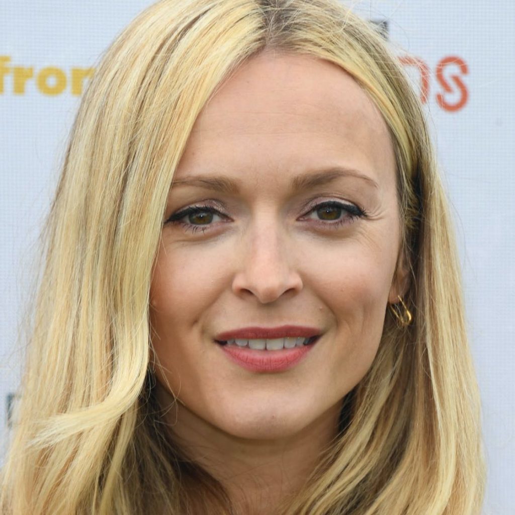 Fearne Cotton Plastic Surgery Face