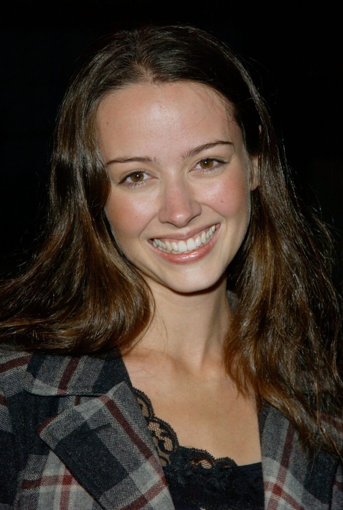 Amy Acker Cosmetic Surgery Face