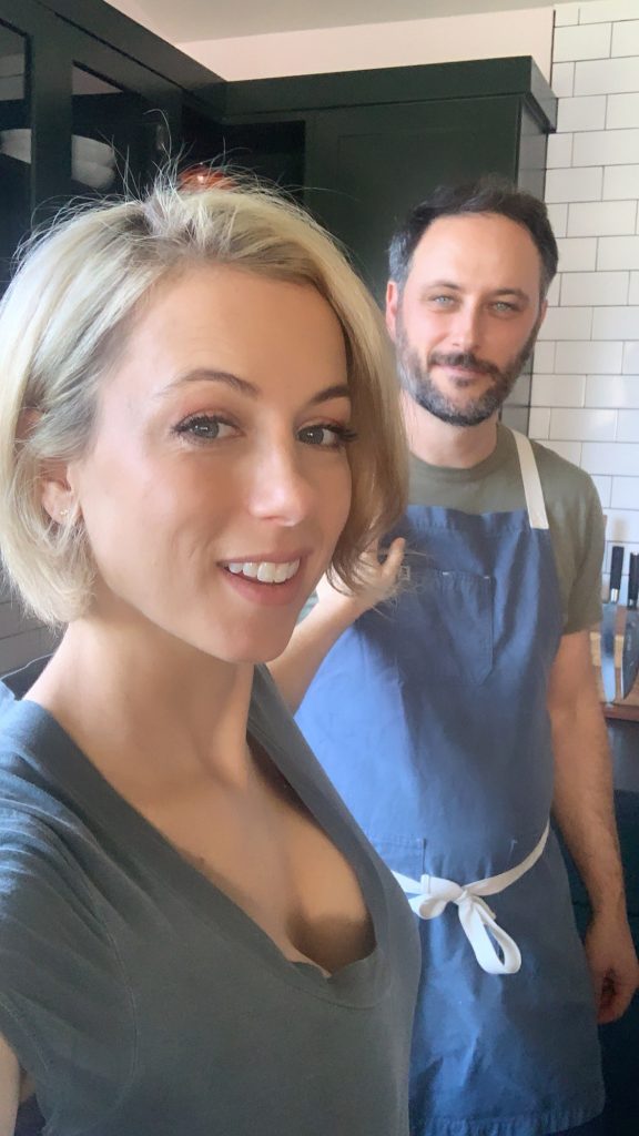 Iliza Shlesinger Cosmetic Surgery Face