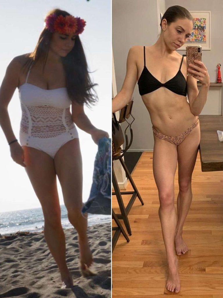 Jenna Johnson Plastic Surgery Body