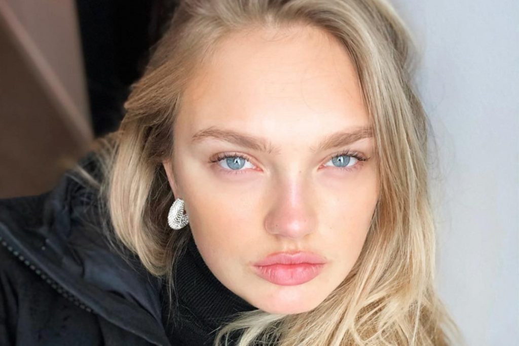 Romee Strijd Plastic Surgery Face