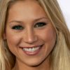 Anna Kournikova Plastic Surgery